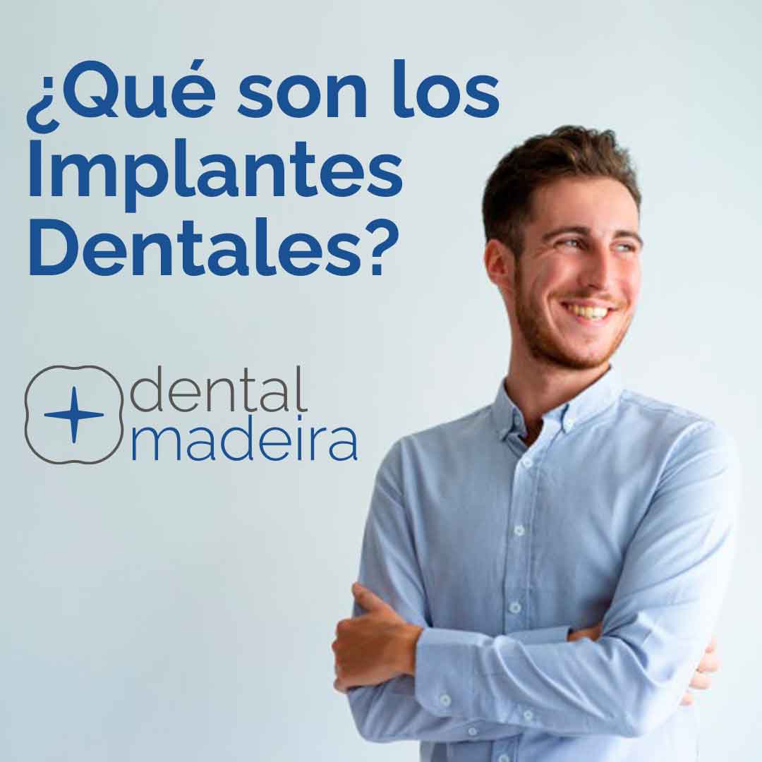 Clinica de implantes dentales