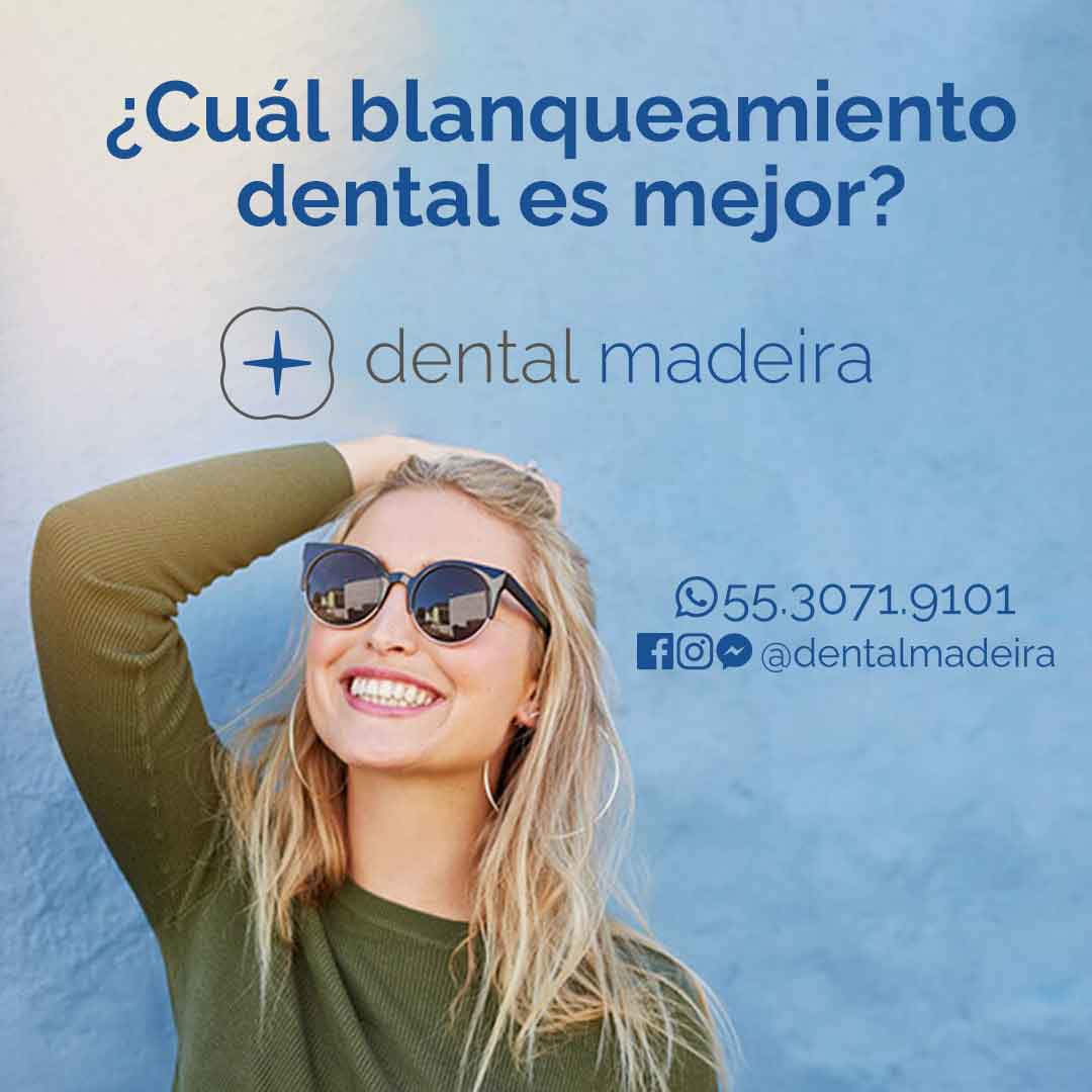 mejor blanqueamiento dental